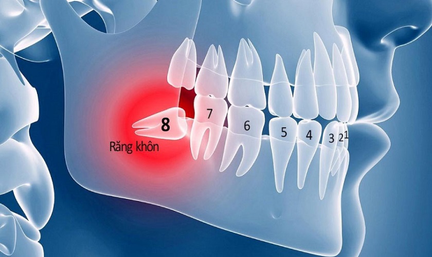 Răng khôn không đảm nhận bất kỳ chức năng ăn nhai hay thẩm mỹ nào
