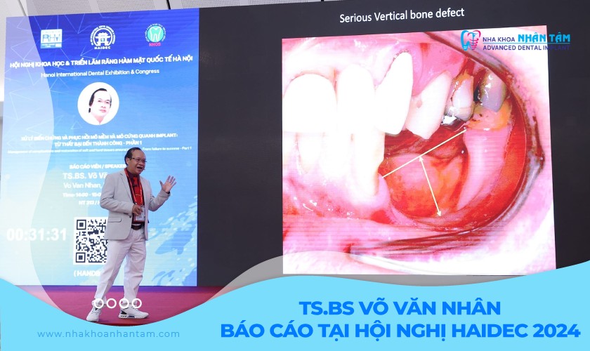 TS.BS Võ Văn Nhân báo cáo tại Hội nghị HAIDEC 2024