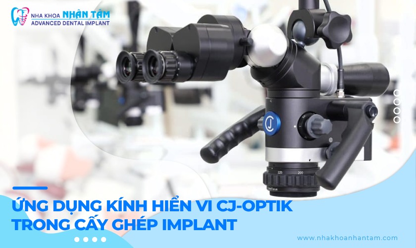 Ứng dụng kính hiển vi CJ-OPTIK trong cấy ghép Implant