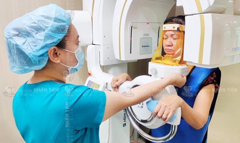 Miễn phí chụp X-quang Conebeam CT 3D