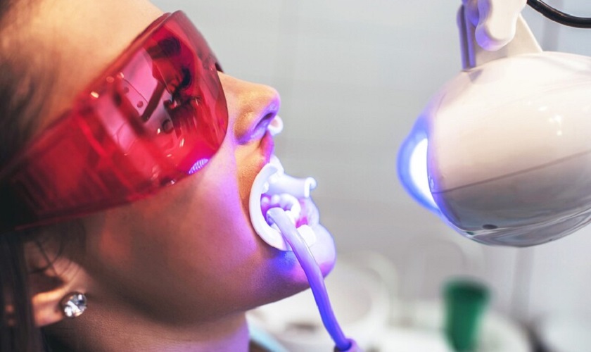 Tẩy trắng răng có hại không với các nguyên liệu tự nhiên?