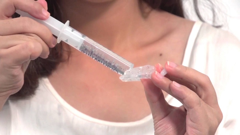 Tẩy trắng răng bằng máng có thể thực hiện tại nhà Tẩy trắng răng bằng máng có thể thực hiện tại nhà