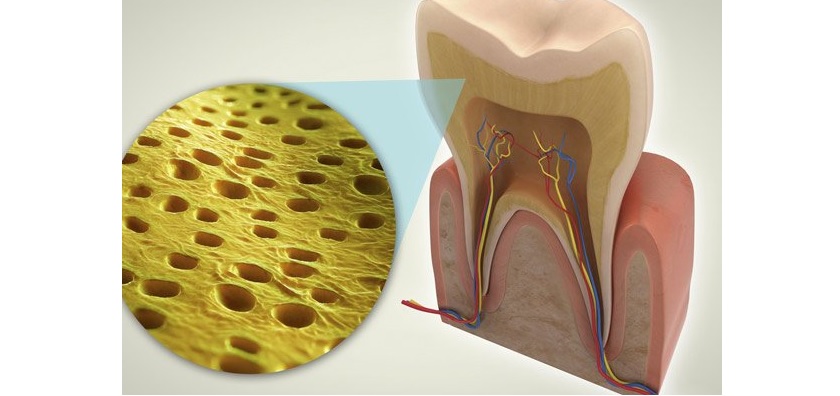 Răng nhạy cảm rất dễ bị ê buốt vì không còn đủ men răng để bảo vệ ngà răng bên trong