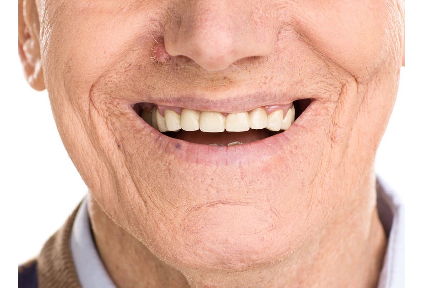 Tuổi tác cũng là một trong những yếu tố tác động đến màu sắc của răng