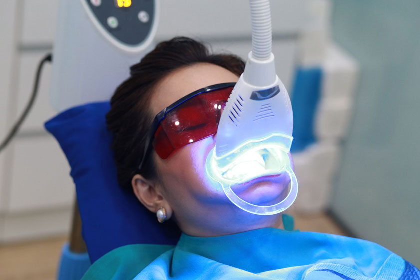 Tẩy trắng răng laser tại nha khoa là cách tẩy trắng răng hiện đại, nhanh chóng và hiệu quả nhất hiện nay