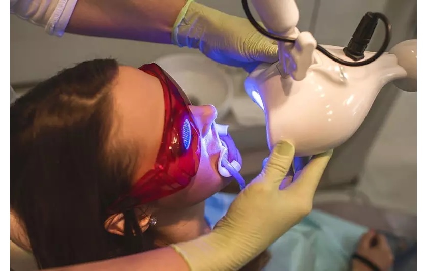 Tẩy trắng răng sau niềng với công nghệ laser Whitening đảm bảo an toàn