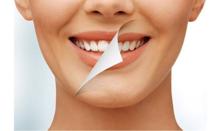 Răng sậm màu - Nguyên nhân và cách điều trị!