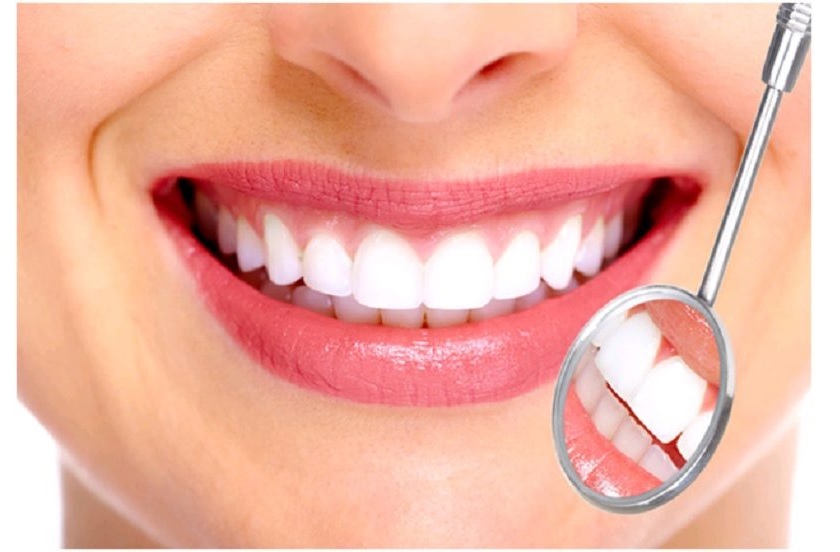 Bọc sứ thẩm mỹ phục hình răng bị sậm màu