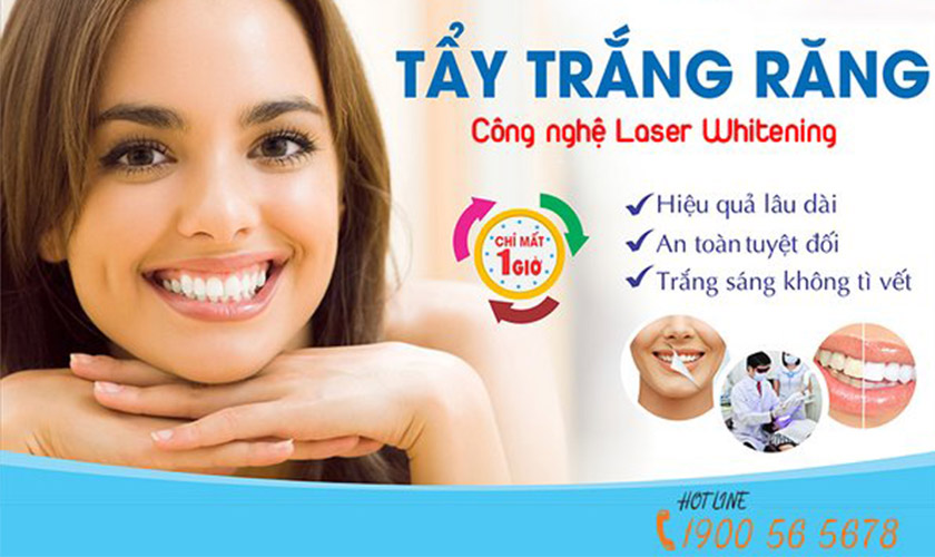 Tẩy trắng răng Laser