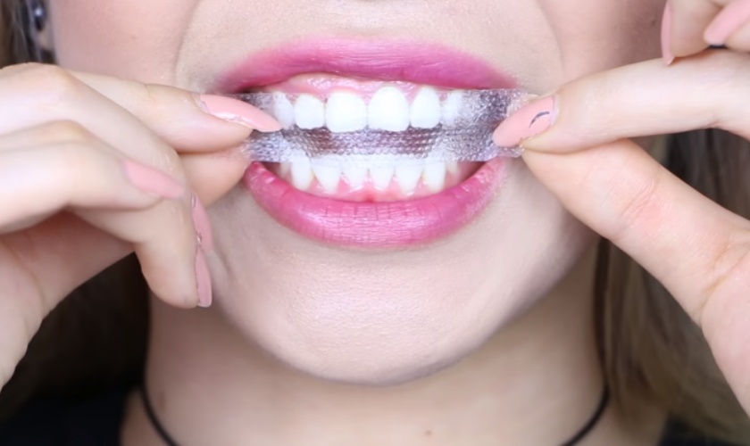 Răng khi sử dụng miếng dán tẩy trắng không duy trì hiệu quả lâu dài như mong đợi
