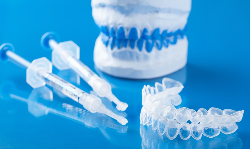 Tẩy trắng răng tại nhà được nhiều người ưa chuộng