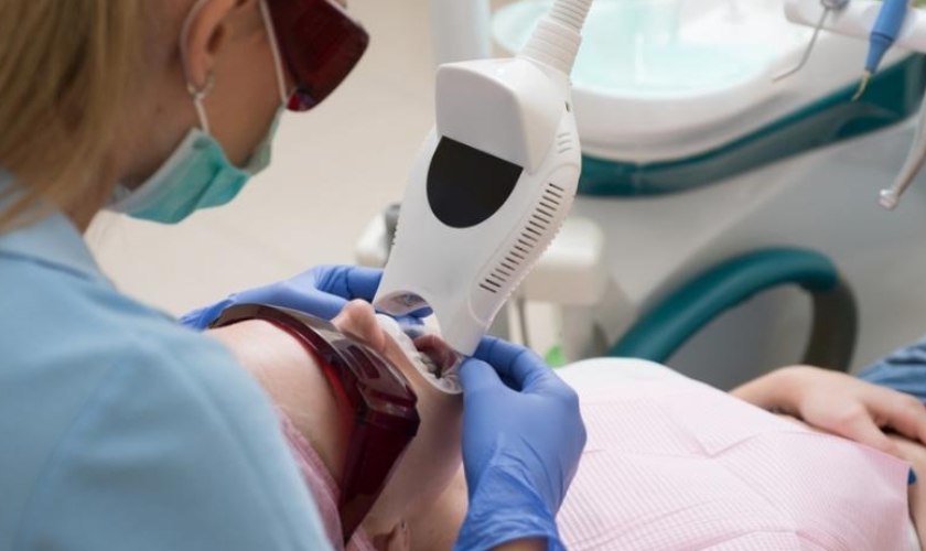Công nghệ tẩy trắng răng Laser Whitening tại Nha Khoa Nhân Tâm được khách đánh giá cao