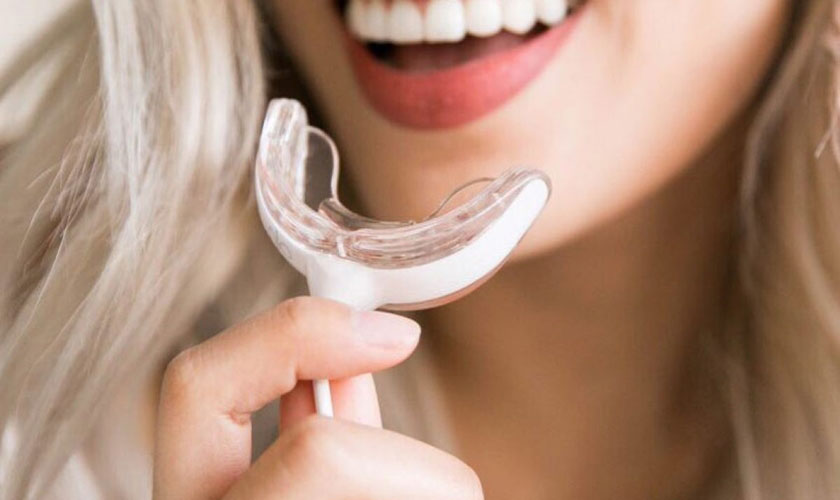 Mức giá của các loại máy làm trắng răng tại nhà là bao nhiêu?