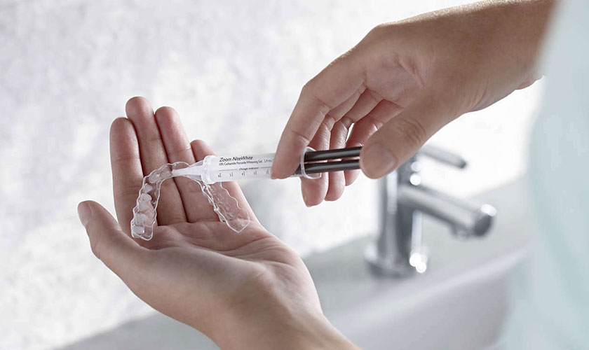 Phương pháp tẩy trắng răng tại nhà bằng máng và thuốc tẩy