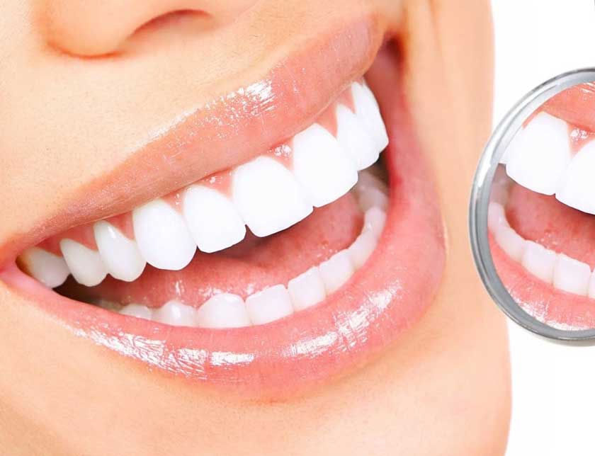 Tẩy trắng răng laser mang lại hiệu quả chỉ sau 40-60 phút thực hiện Tẩy trắng răng laser mang lại hiệu quả chỉ sau 40-60 phút thực hiện