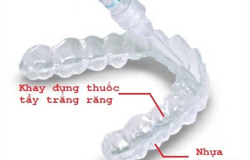 Máng tẩy trắng răng