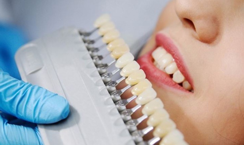 Trước khi tẩy trắng, bác sĩ sẽ thăm khám tổng quát tình trạng răng miệng của khách hàng