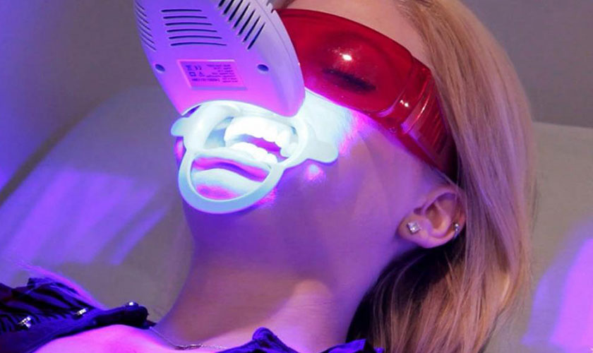 Công nghệ tẩy trắng răng Laser Whitening
