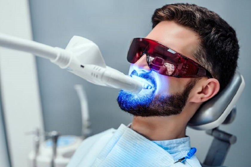 Công nghệ tẩy trắng răng Laser Whitening