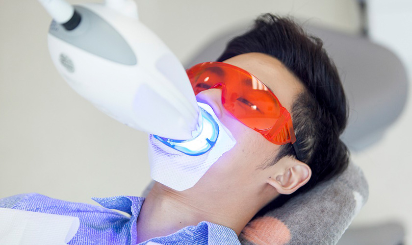  Bác sĩ có chuyên môn sẽ thực hiện tẩy trắng răng giúp bạn tại phòng khám. 