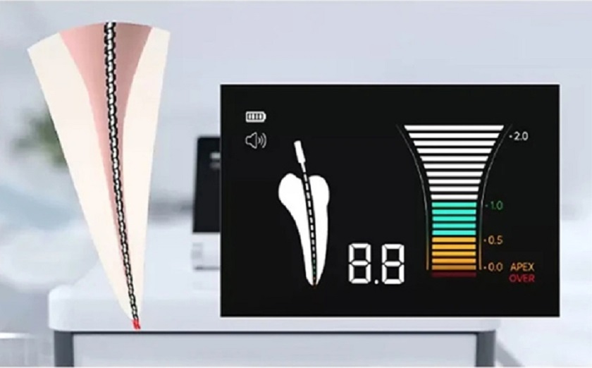 Máy đo chiều dài ống tủy sử dụng nhiều phương pháp khác nhau để xác định chiều dài của ống tủy