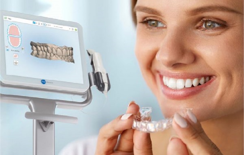 Công nghệ lấy dấu hàm hiện đại trong quy trình niềng răng trong suốt