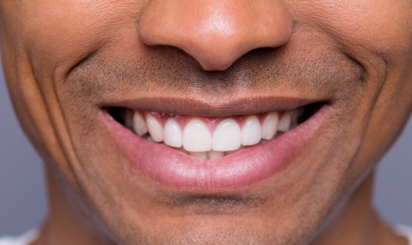 Hàm răng trắng sáng, nụ cười rạng rỡ giúp bạn ghi điểm với người đối diện Hàm răng trắng sáng, nụ cười rạng rỡ giúp bạn ghi điểm với người đối diện