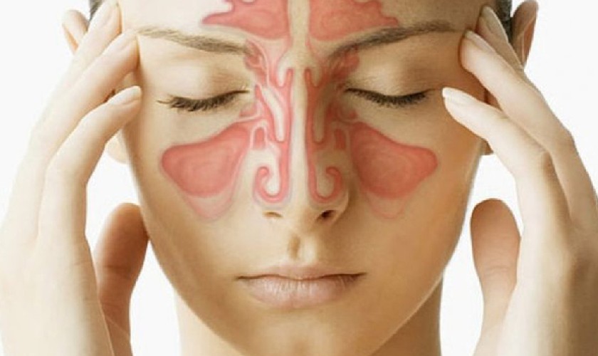Viêm xoang hàm do nhiều nguyên nhân gây nên