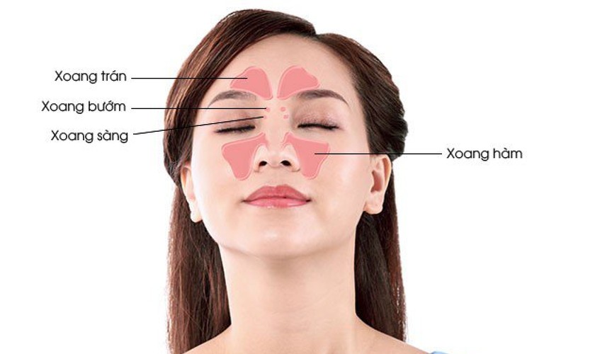 Viêm xoang hàm là trạng thái viêm nhiễm của lớp niêm mạc xoang