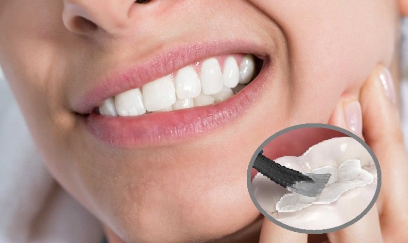 Chỗ trám răng bị ê buốt phải làm sao?