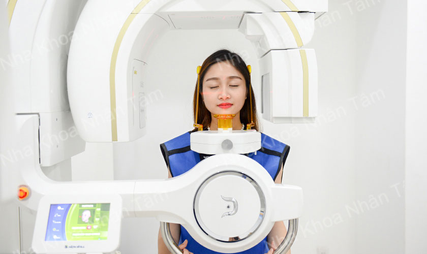 Chụp phim CT Cone Beam 3D