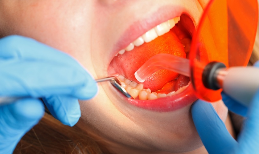 Cần thực hiện trám răng tại địa chỉ nha khoa uy tín