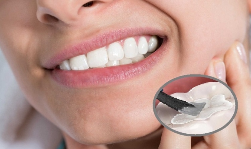 Xoa tan nỗi lo đau nhức với công nghệ trám răng hiện đại