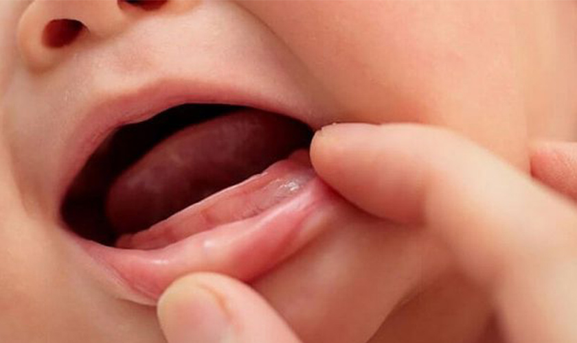 Cách làm cho răng mọc nhanh nhất khi răng sữa mọc chậm