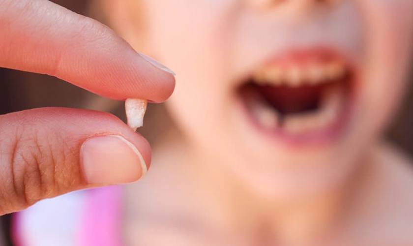 Bảng giá nhổ răng trẻ em. Trẻ cần nhổ răng khi nào?