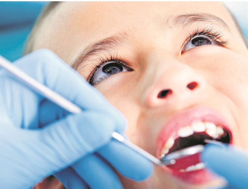 Răng sữa bị sâu cần được trám