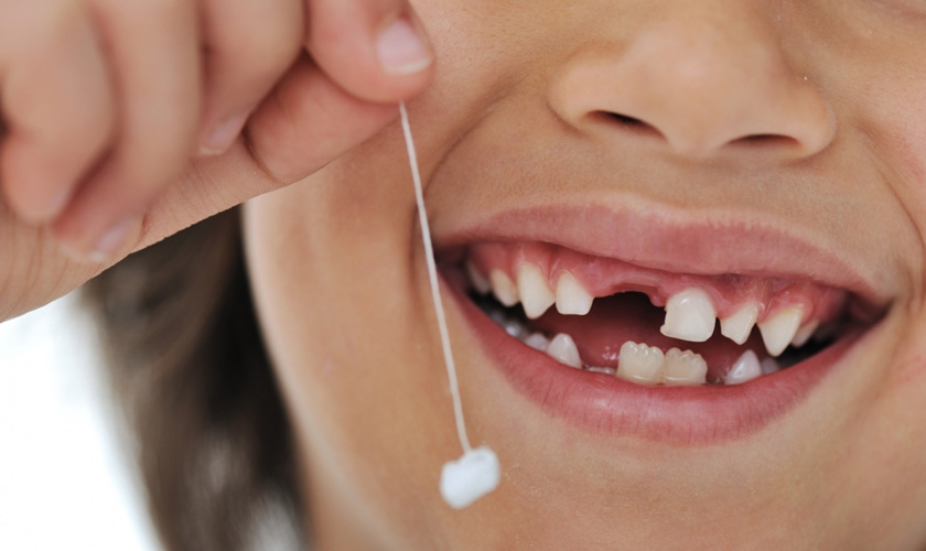 Răng sữa nhổ sớm có thể ảnh hưởng đến răng vĩnh viễn sau này