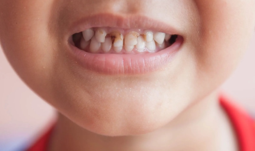 Khám răng định kỳ giúp trẻ em biết cách chăm sóc răng miệng tốt Khám răng định kỳ giúp trẻ em biết cách chăm sóc răng miệng tốt