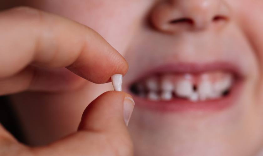 Nhổ răng cho trẻ trường hợp răng trẻ bị nhiễm trùng nặng Nhổ răng cho trẻ trường hợp răng trẻ bị nhiễm trùng nặng