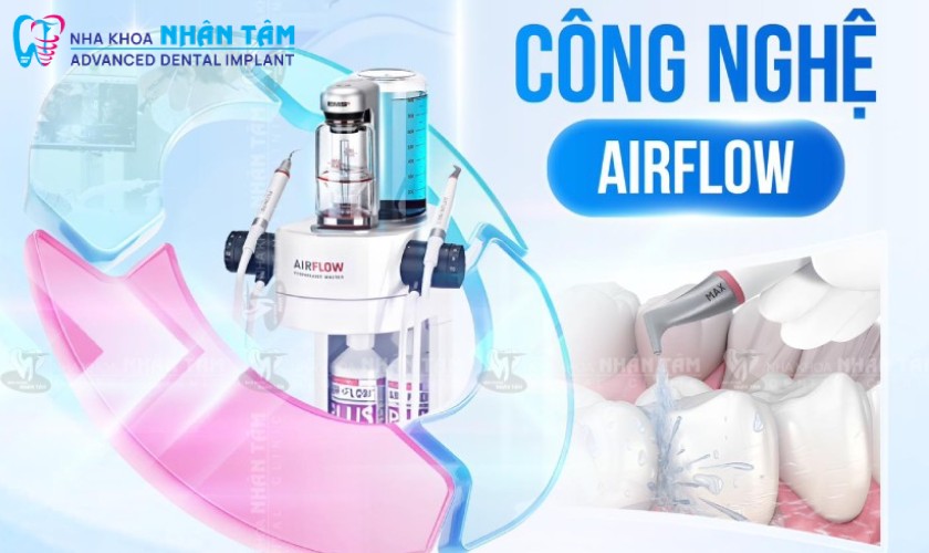 Công nghệ Airflow giúp làm sạch răng hiệu quả Công nghệ Airflow giúp làm sạch răng hiệu quả