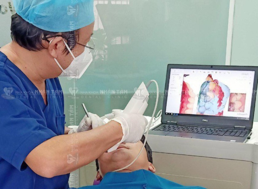 Công nghệ lấy dấu răng kỹ thuật số 3Shape 3D