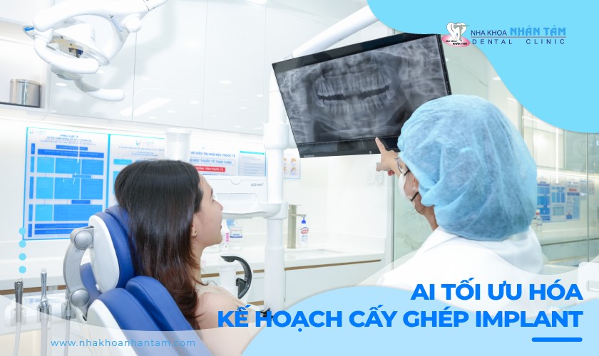 Công nghệ AI tối ưu hóa kế hoạch cấy ghép Implant thế nào?