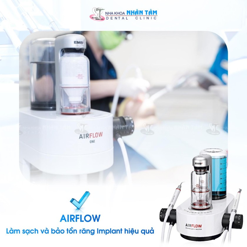 Công nghệ Airflow giúp loại bỏ mảng bám, vi khuẩn trên bề mặt Implant một cách nhẹ nhàng Công nghệ Airflow giúp loại bỏ mảng bám, vi khuẩn trên bề mặt Implant một cách nhẹ nhàng