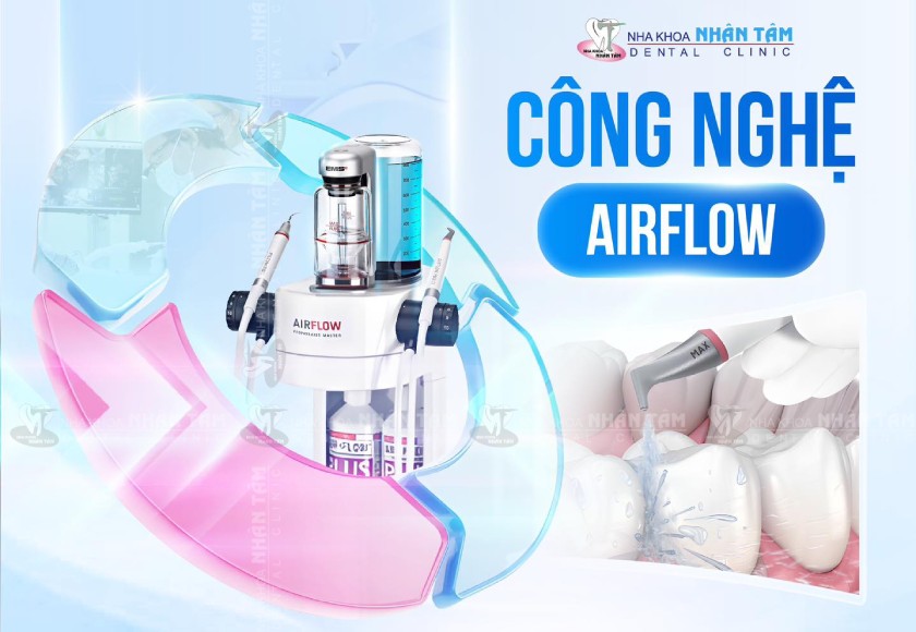 Nha khoa Nhân Tâm tiên phong ứng dụng công nghệ Airflow Nha khoa Nhân Tâm tiên phong ứng dụng công nghệ Airflow