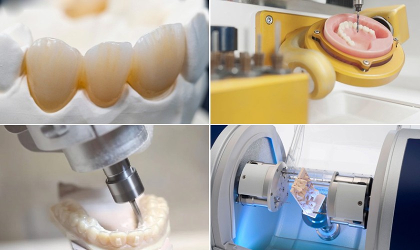 Công nghệ CAD/CAM giúp gia tăng độ chính xác phục hình