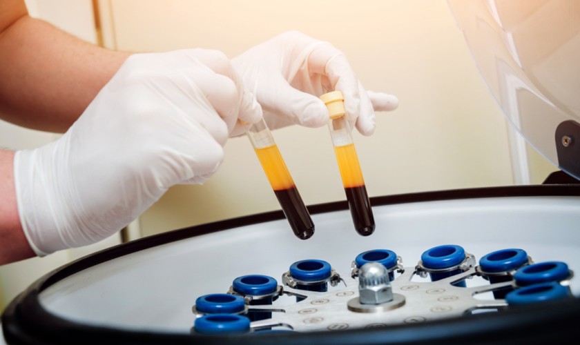 Công nghệ màng PRF mang lại nhiều ưu điểm vượt trội trong cấy ghép Implant