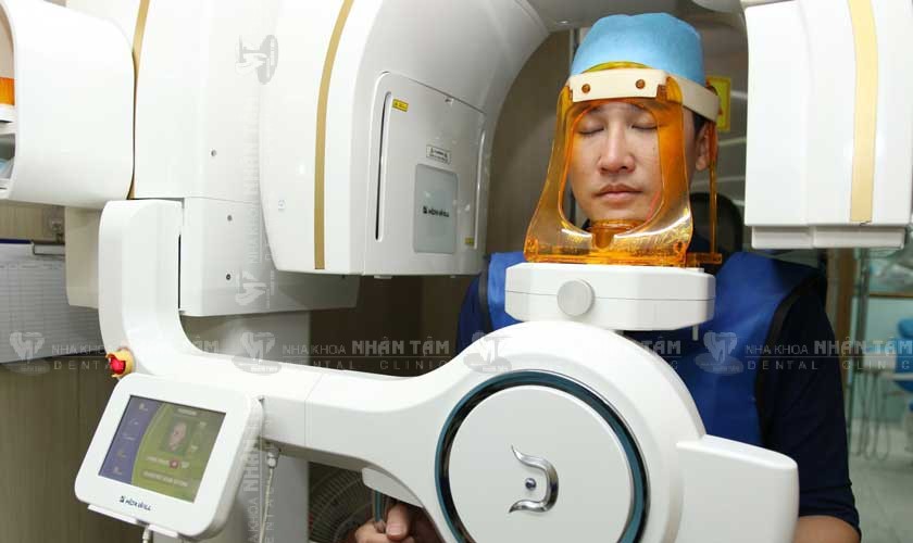 Chụp phim CBCT 3D giúp bác sĩ đánh giá tình trạng xương hàm của khách hàng Chụp phim CBCT 3D giúp bác sĩ đánh giá tình trạng xương hàm của khách hàng
