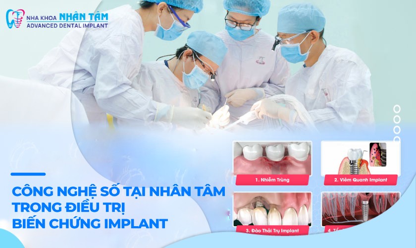 Công nghệ số tại Nhân Tâm trong điều trị biến chứng Implant