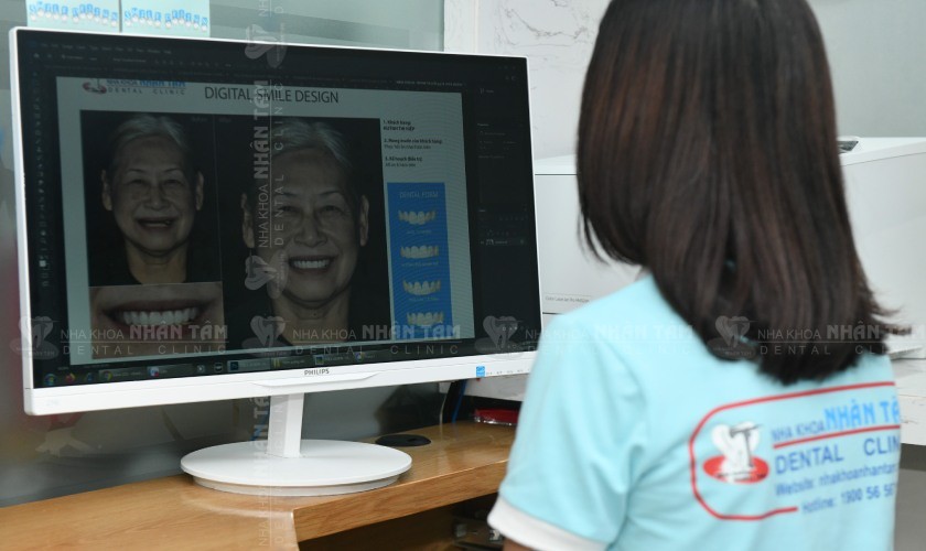 Ứng dụng công nghệ quét mặt 3 chiều tại Nha khoa Nhân Tâm