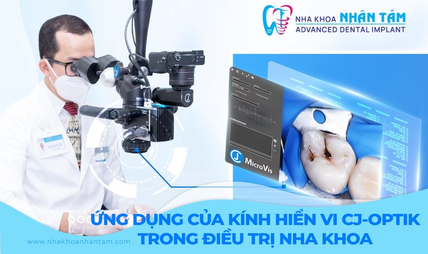 Ứng dụng của kính hiển vi CJ-Optik trong điều trị nha khoa